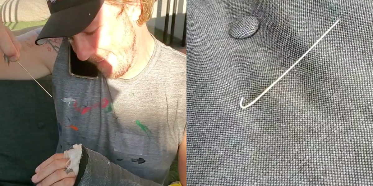 Kristen Bell Shares Video Of Dax Shepard Removing Pin From Broken Arm