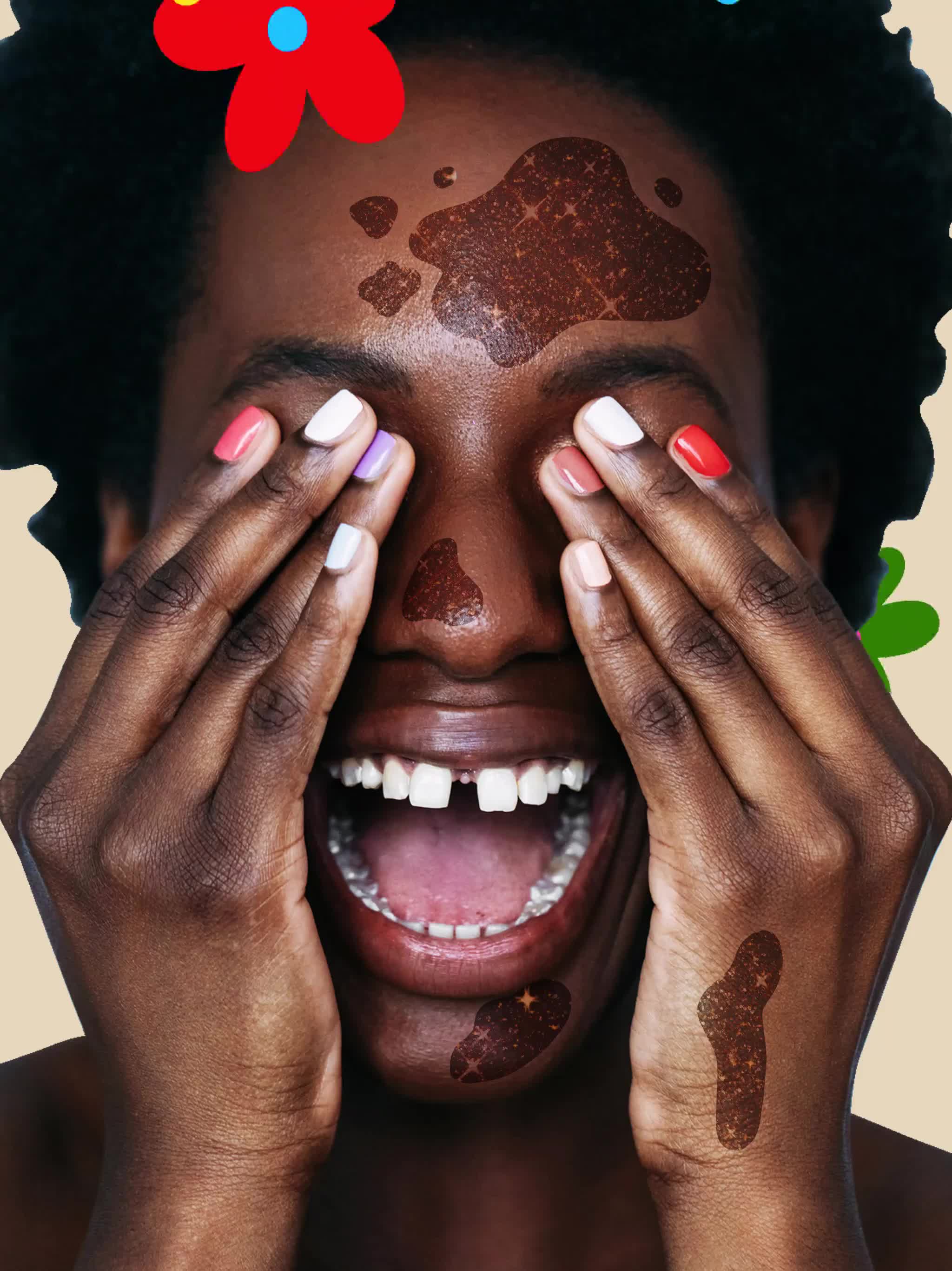 How to get rid of dark spots on black skin